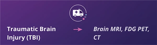 Informational graphic showing the diagnostic path for Traumatic Brain Injury (TBI), linking the condition to Brain MRI, FDG PET, and CT imaging services at RadNet.