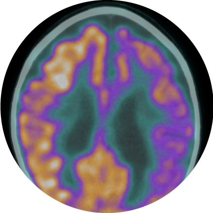 PET/MRI icon